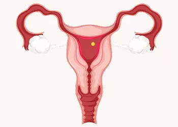 Your Path to Parenthood with Blocked Fallopian Tubes