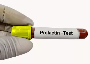 Normal Prolactin Levels to Get Pregnant