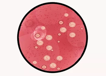 Yeast Infection: Symptoms, Causes and Effective Treatments