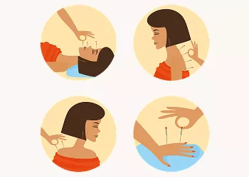 How Fertility Acupuncture May Enhance Treatment Success