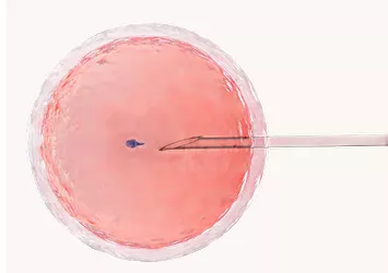 Understanding Embryo Donor