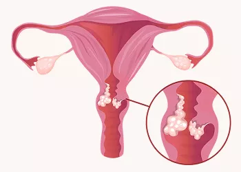 Cervical Mucus and Ovulation: Understanding the Relationship