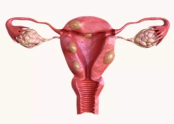 Is FSH (Follicle Stimulating Hormone) the Best Fertility Test Available?