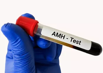 Discover Your Fertility Potential with the Anti-Mullerian Hormone (AMH) Test