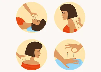 Acupuncture’s Impact On IVF